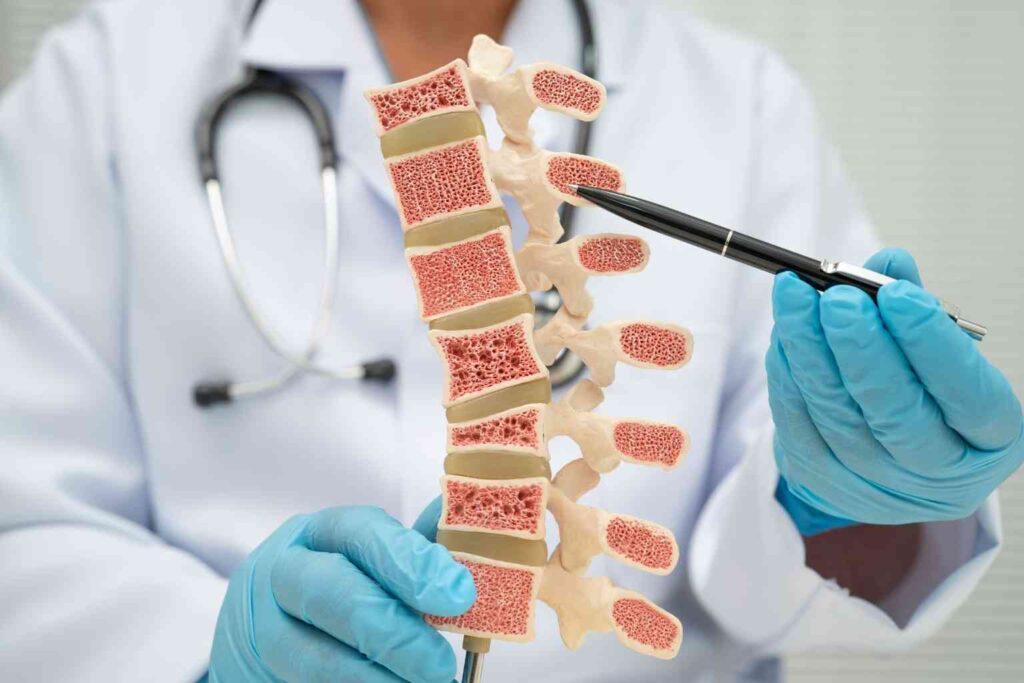 Horny goat weed bone health