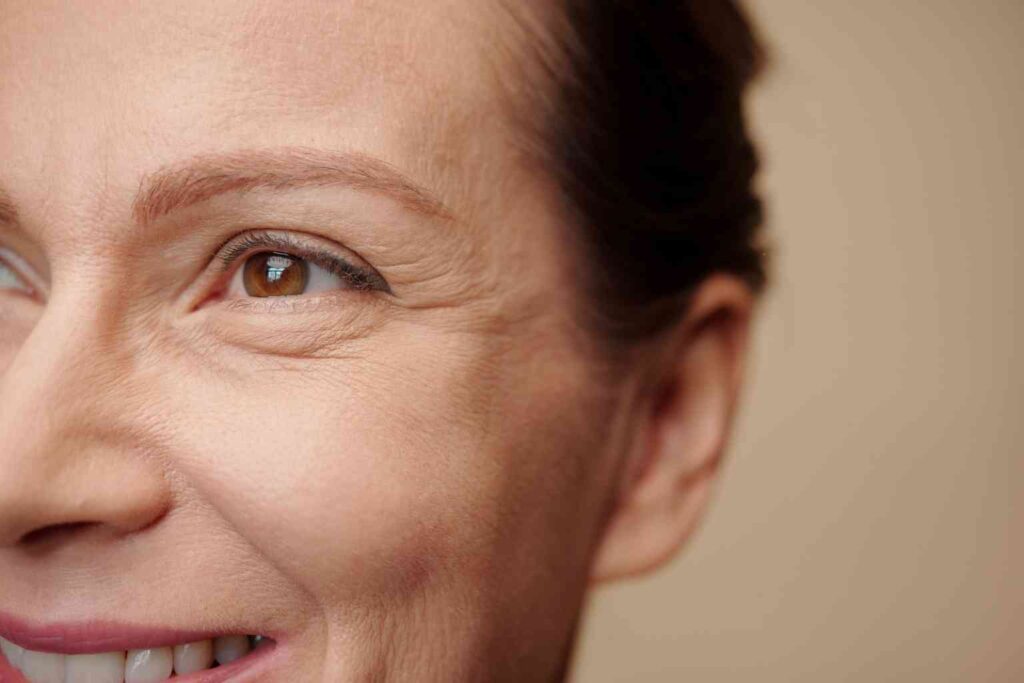 hyaluronic acid for wrinkles