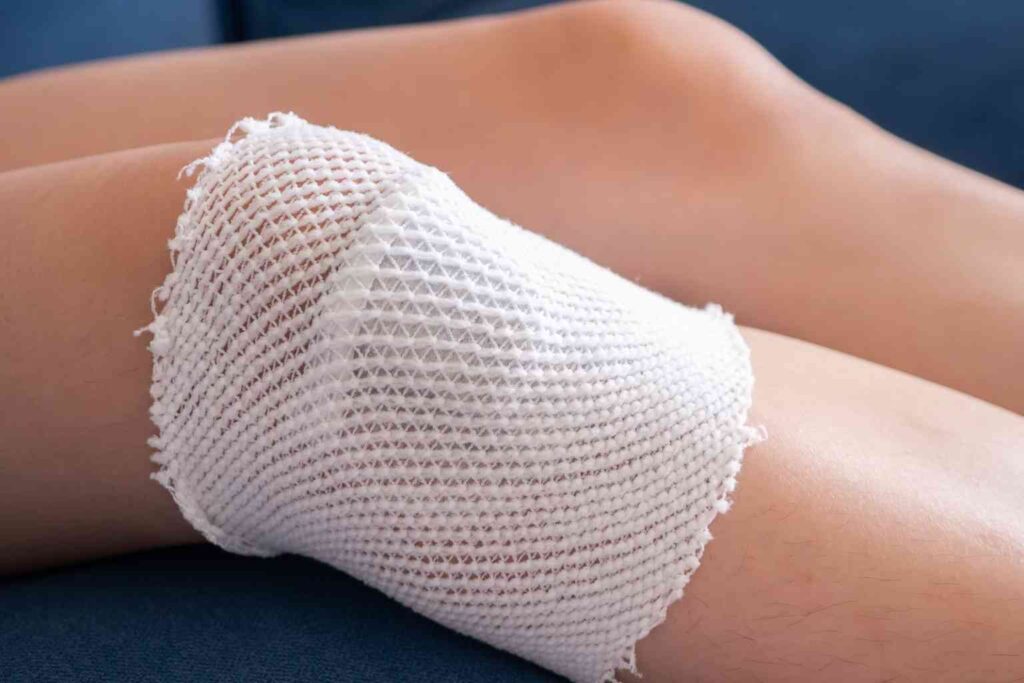 hyaluronic acid wound healing